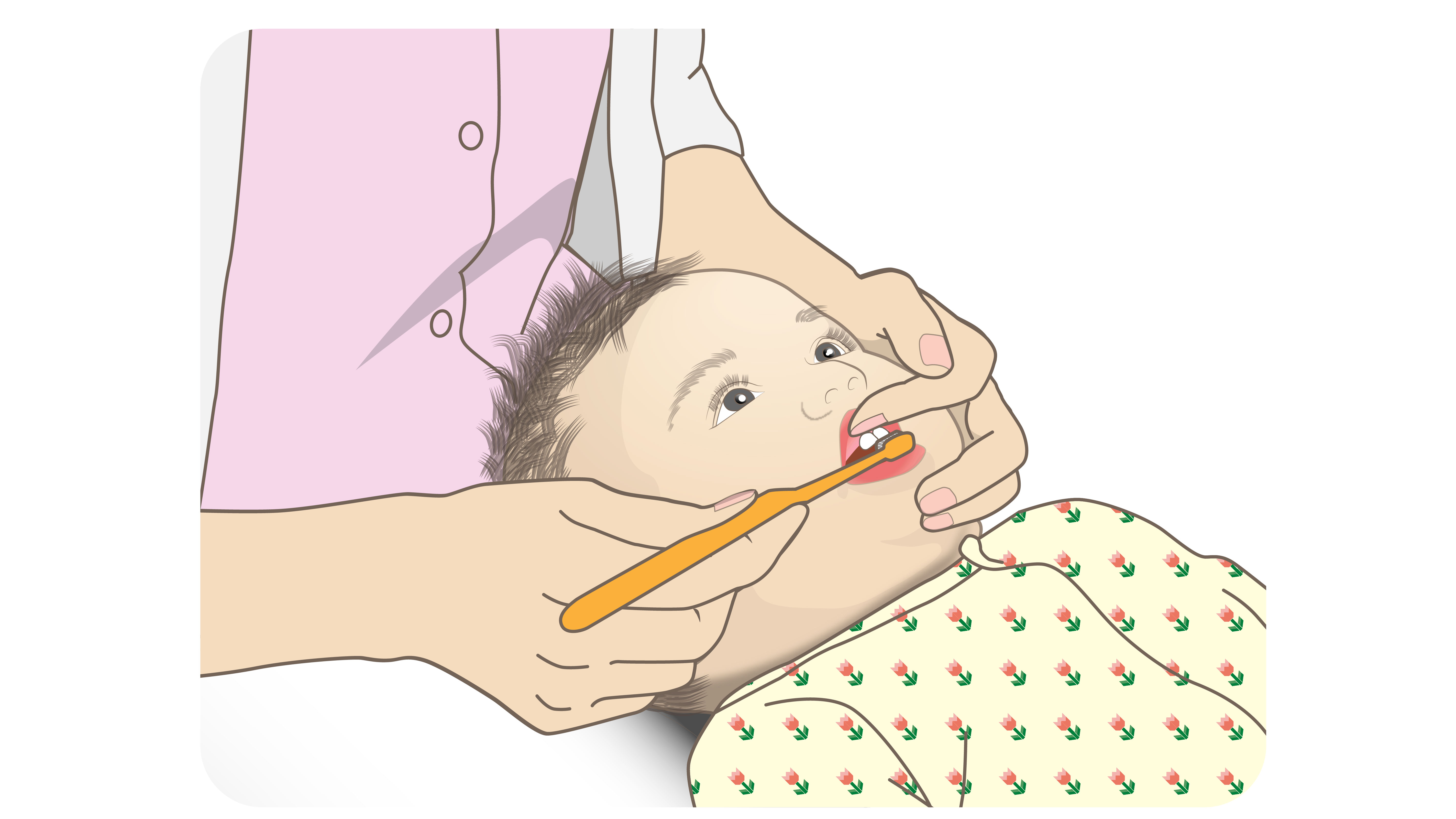 上唇小帯保護する磨き方